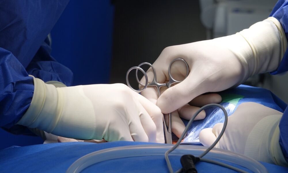 Appendicitis