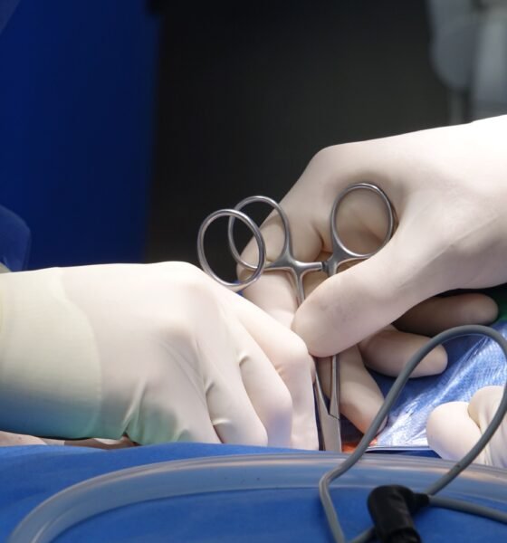 Appendicitis