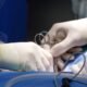 Appendicitis